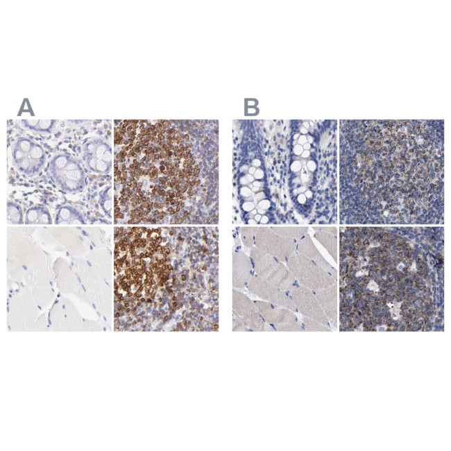 Lrmp Antibody in Immunohistochemistry (IHC)