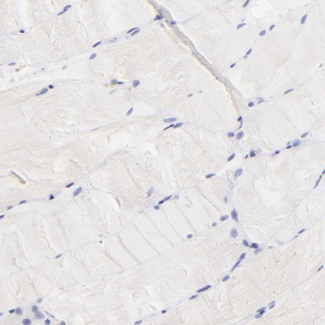 Lrmp Antibody in Immunohistochemistry (IHC)