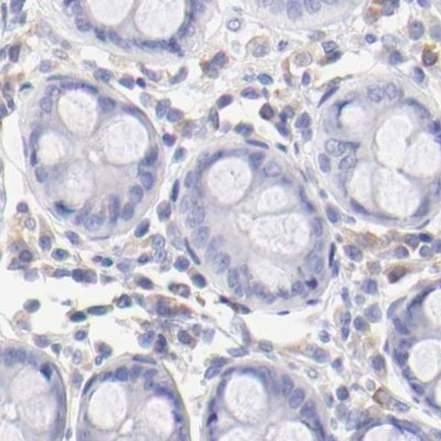 Lrmp Antibody in Immunohistochemistry (IHC)