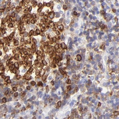 Lrmp Antibody in Immunohistochemistry (IHC)