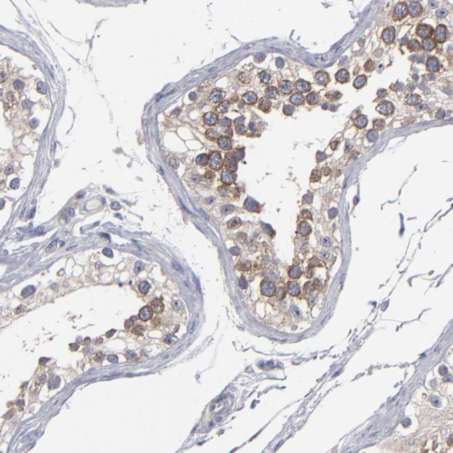 CEP97 Antibody in Immunohistochemistry (IHC)