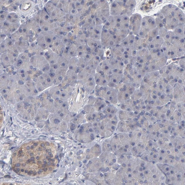 CEP97 Antibody in Immunohistochemistry (IHC)