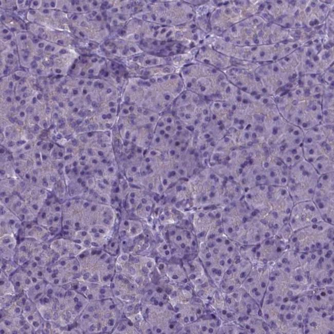 MLC1 Antibody in Immunohistochemistry (IHC)