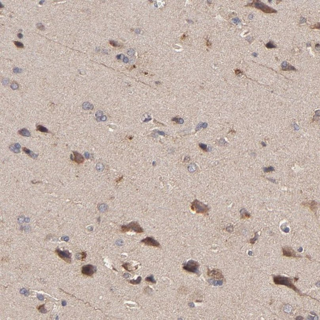 STON2 Antibody in Immunohistochemistry (IHC)