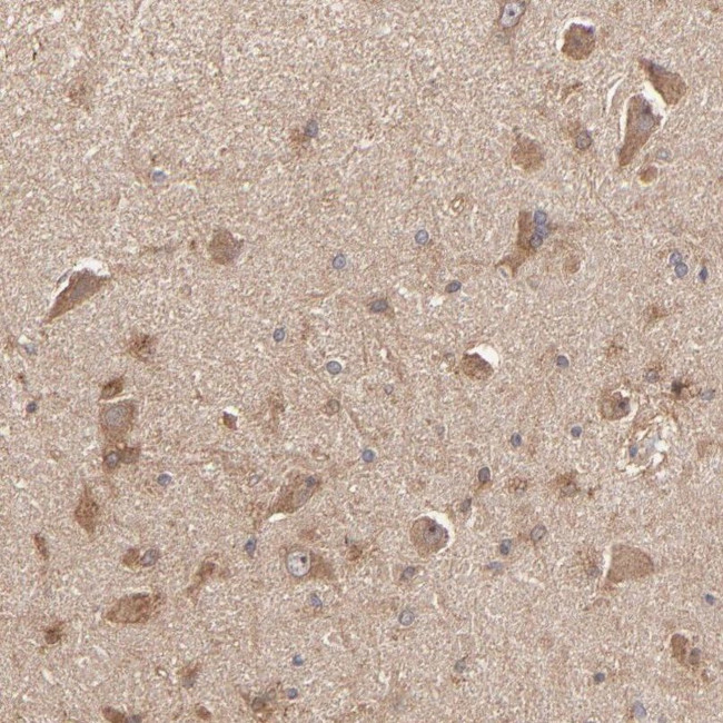 STON2 Antibody in Immunohistochemistry (IHC)