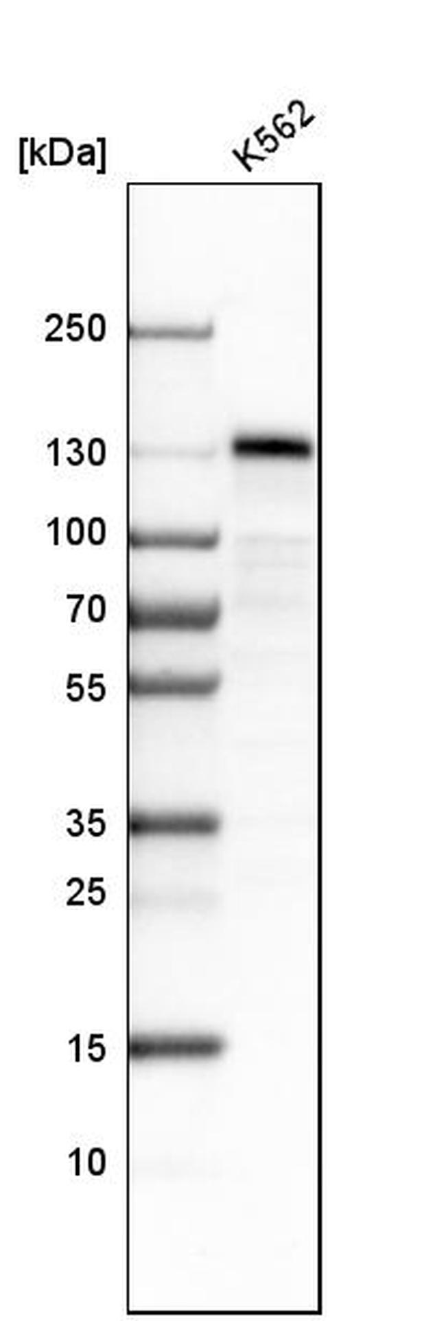 STON2 Antibody in Western Blot (WB)