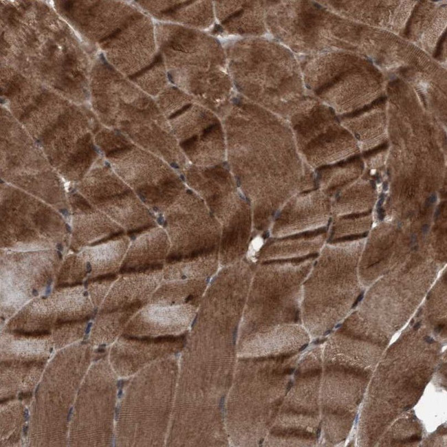 PLXNB2 Antibody in Immunohistochemistry (IHC)