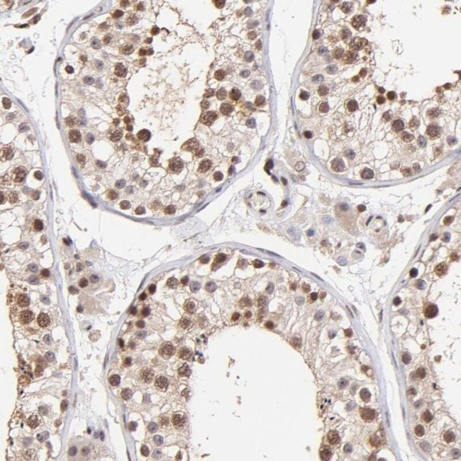 WDR25 Antibody in Immunohistochemistry (IHC)