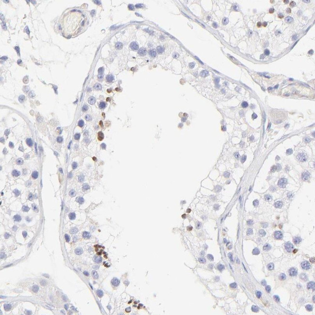 ACTRT1 Antibody in Immunohistochemistry (IHC)