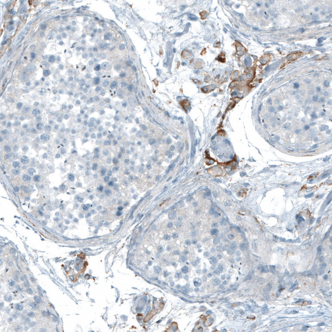 NLGN3 Antibody in Immunohistochemistry (IHC)