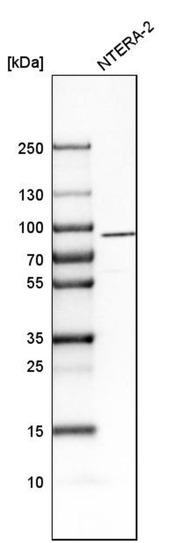 NLGN3 Antibody in Western Blot (WB)