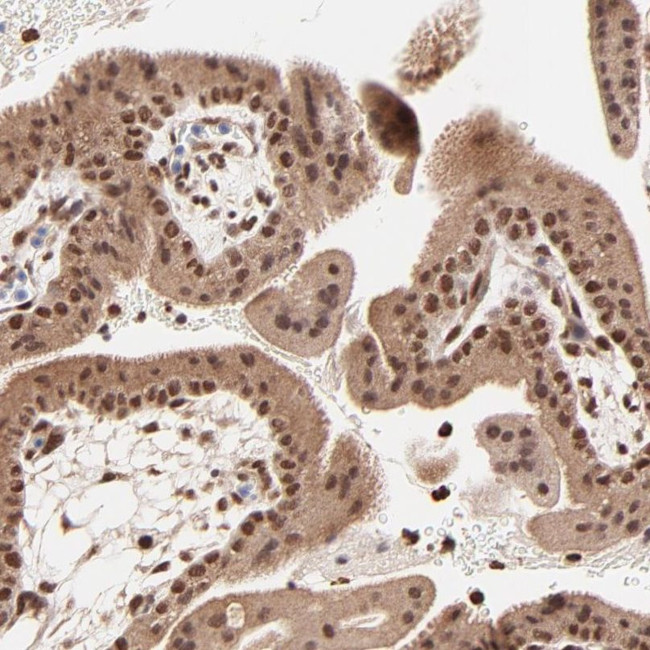 MED12 Antibody in Immunohistochemistry (IHC)