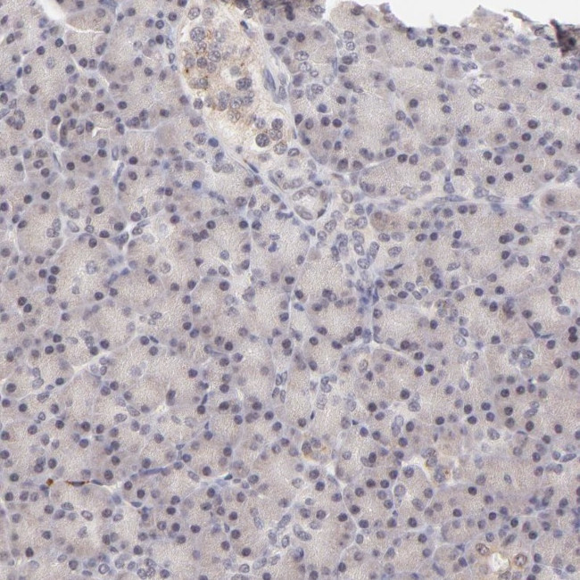 MED12 Antibody in Immunohistochemistry (IHC)