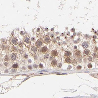 MED12 Antibody in Immunohistochemistry (IHC)