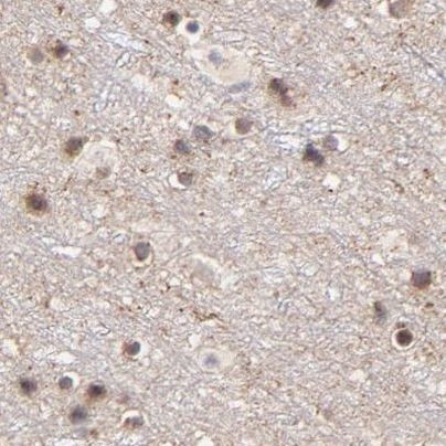 MED12 Antibody in Immunohistochemistry (IHC)