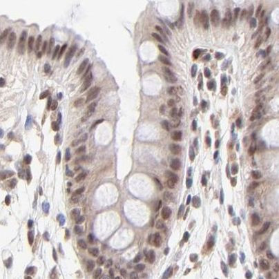 MED12 Antibody in Immunohistochemistry (IHC)