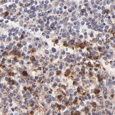 MED12 Antibody in Immunohistochemistry (IHC)