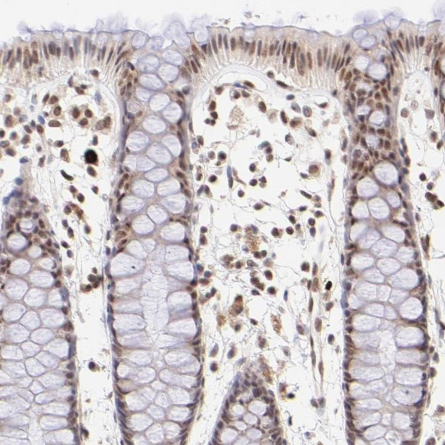 MED12 Antibody in Immunohistochemistry (IHC)