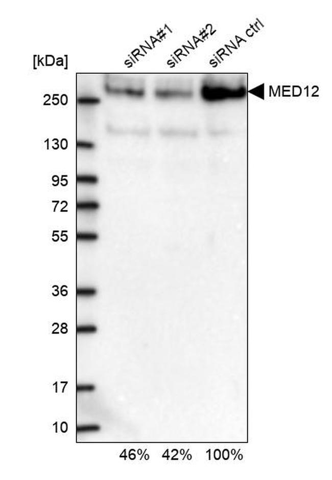 MED12 Antibody in Western Blot (WB)