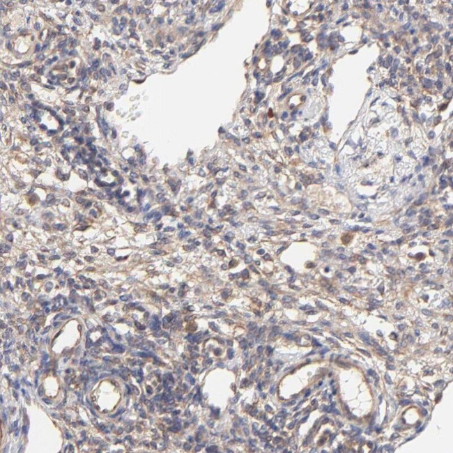 SCUBE1 Antibody in Immunohistochemistry (IHC)