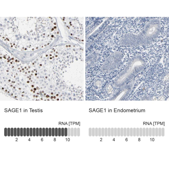 SAGE1 Antibody in Immunohistochemistry (IHC)