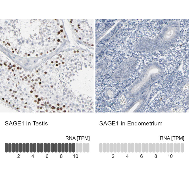 SAGE1 Antibody