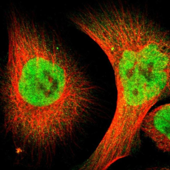 ZMYM3 Antibody in Immunocytochemistry (ICC/IF)