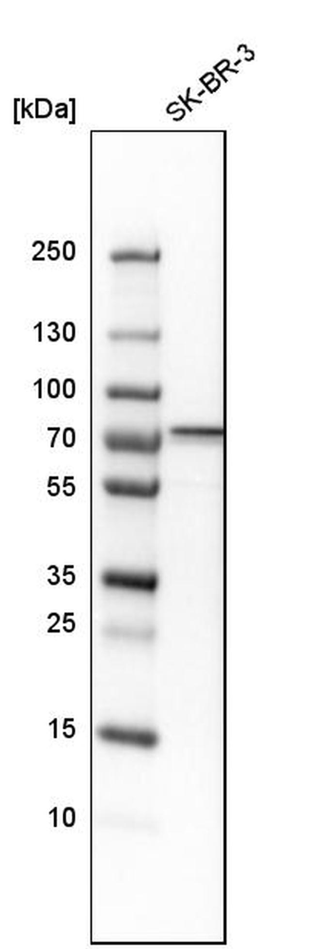 OGFOD1 Antibody in Western Blot (WB)