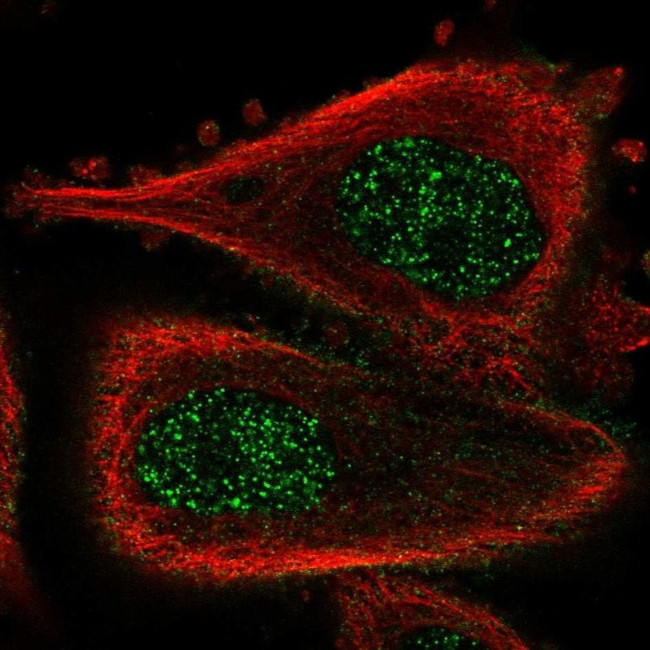 ABLIM3 Antibody in Immunocytochemistry (ICC/IF)