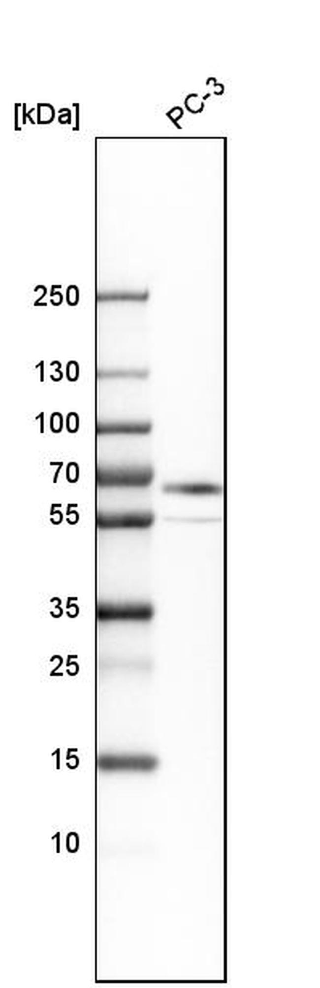 ABLIM3 Antibody in Western Blot (WB)