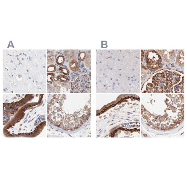 CD2AP Antibody in Immunohistochemistry (IHC)