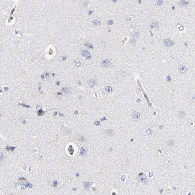 CD2AP Antibody in Immunohistochemistry (IHC)