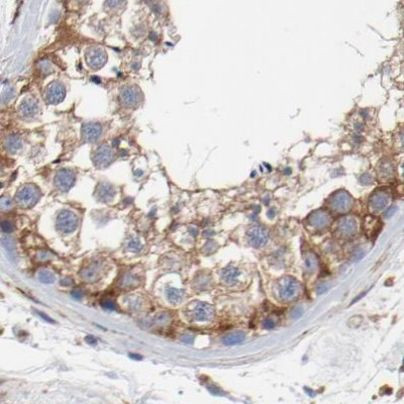 CD2AP Antibody in Immunohistochemistry (IHC)