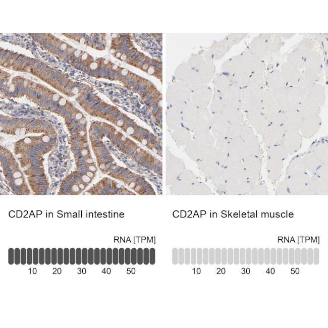 CD2AP Antibody