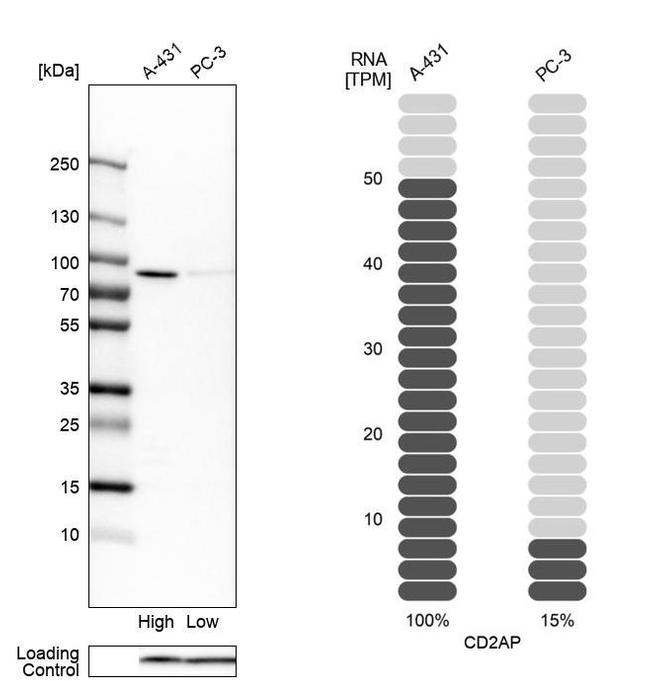 CD2AP Antibody in Western Blot (WB)