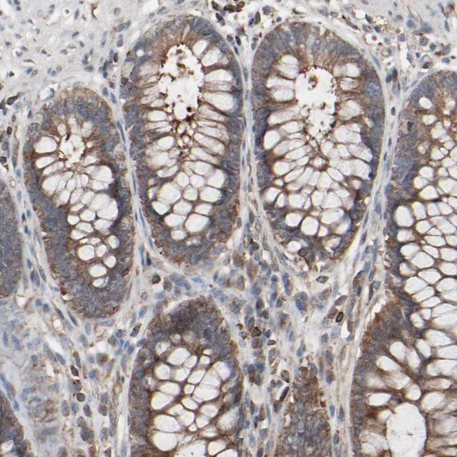 Optineurin Antibody in Immunohistochemistry (IHC)