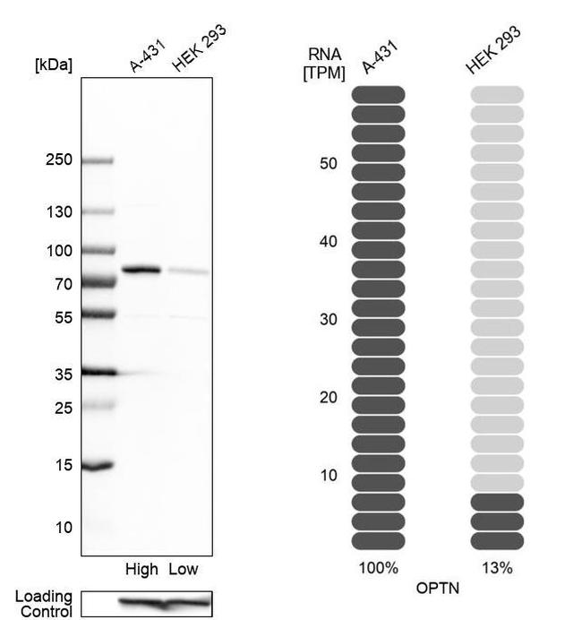 Optineurin Antibody in Western Blot (WB)