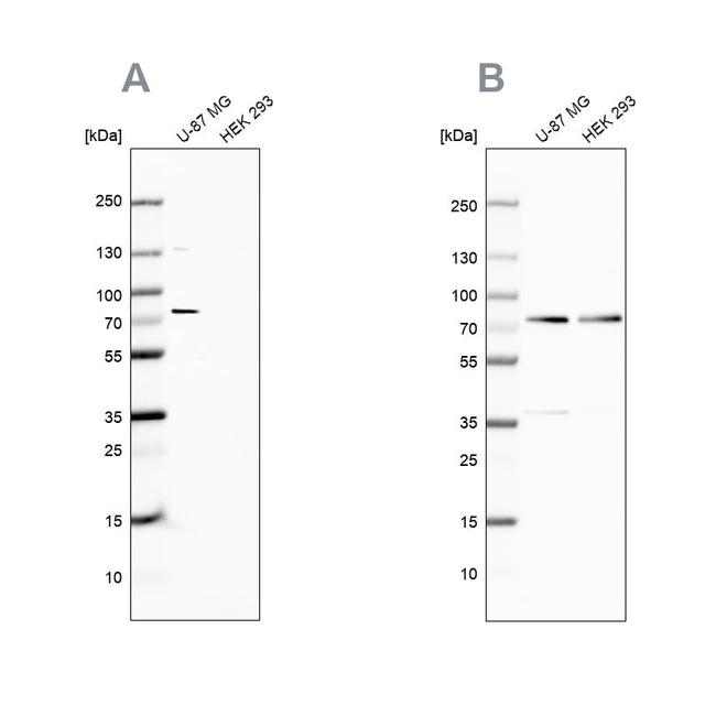 Optineurin Antibody in Western Blot (WB)