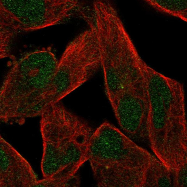 ZNF780B Antibody in Immunocytochemistry (ICC/IF)