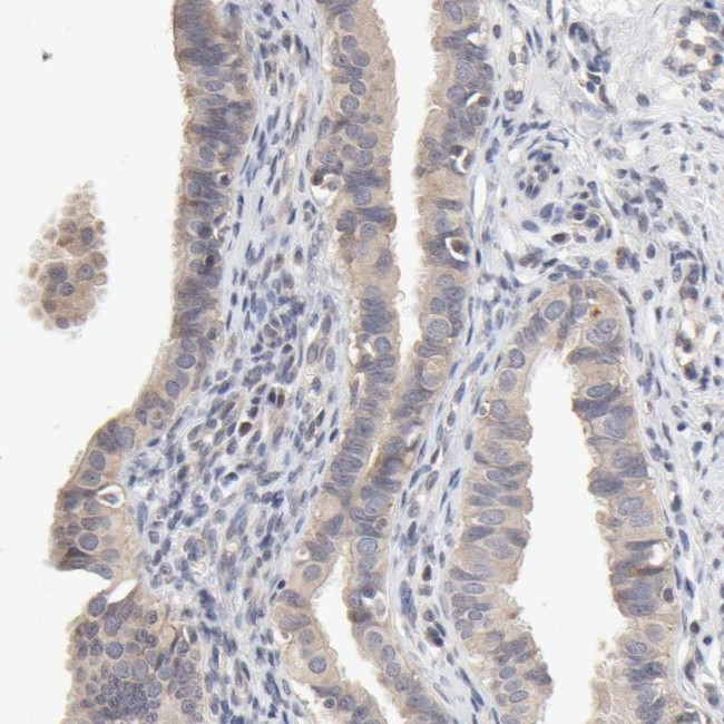 ZNF157 Antibody in Immunohistochemistry (IHC)