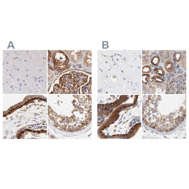 CD2AP Antibody in Immunohistochemistry (IHC)