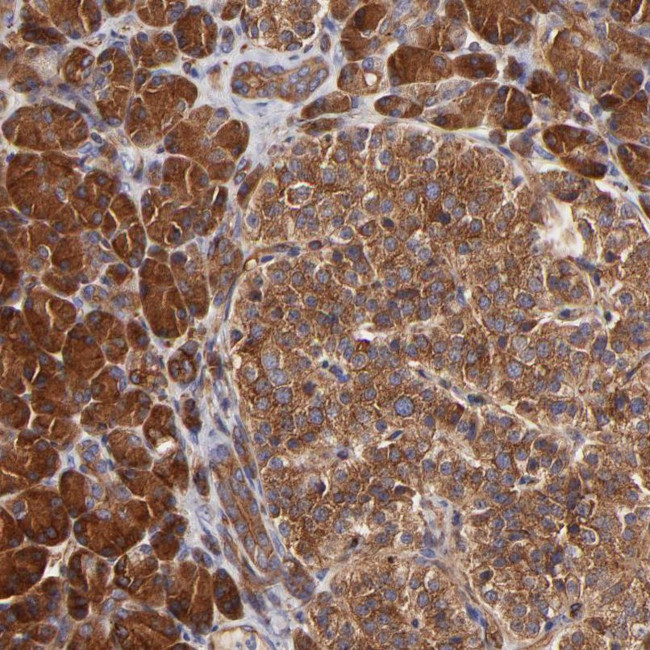 CD2AP Antibody in Immunohistochemistry (IHC)