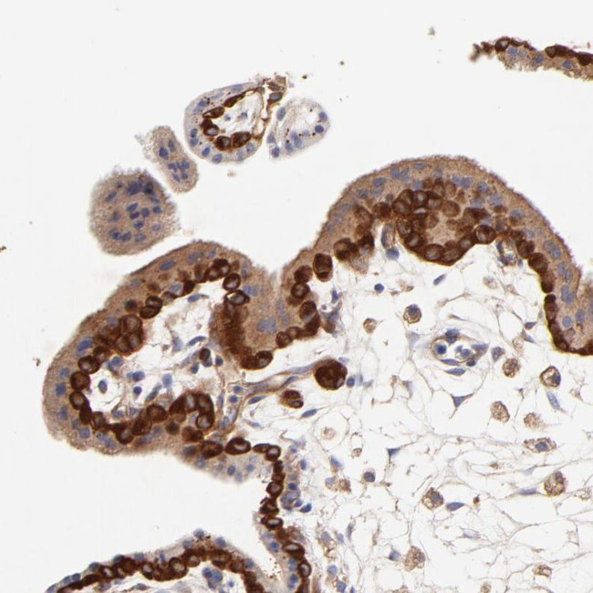 CD2AP Antibody in Immunohistochemistry (IHC)