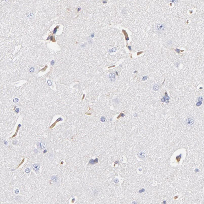 CD2AP Antibody in Immunohistochemistry (IHC)