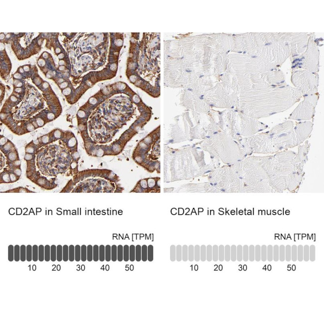 CD2AP Antibody