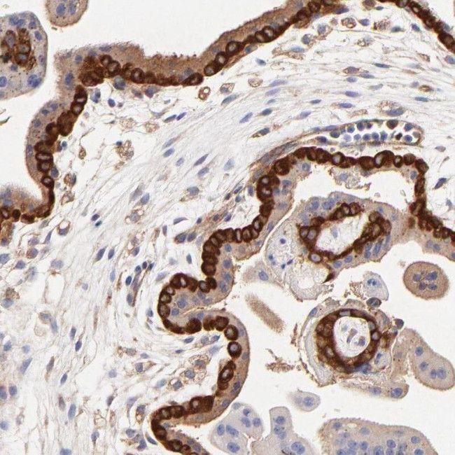 CD2AP Antibody in Immunohistochemistry (IHC)