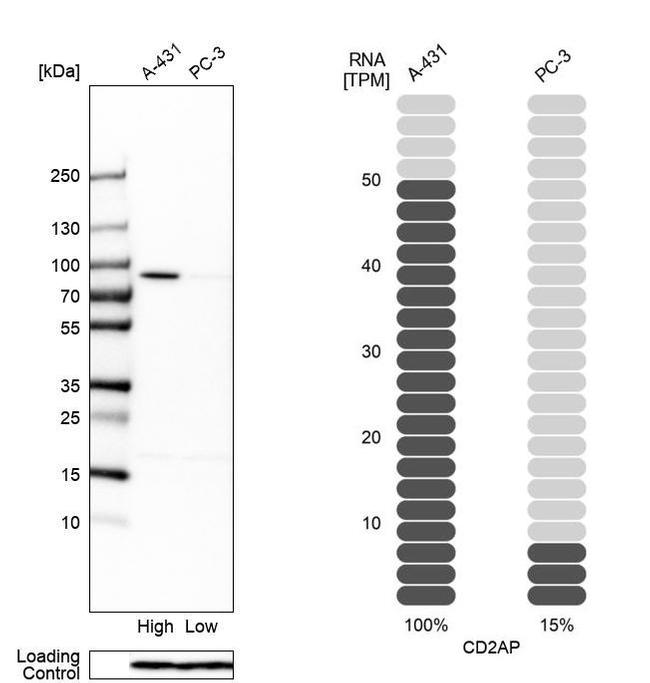 CD2AP Antibody in Western Blot (WB)