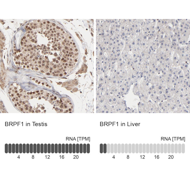 BRPF1 Antibody in Immunohistochemistry (IHC)