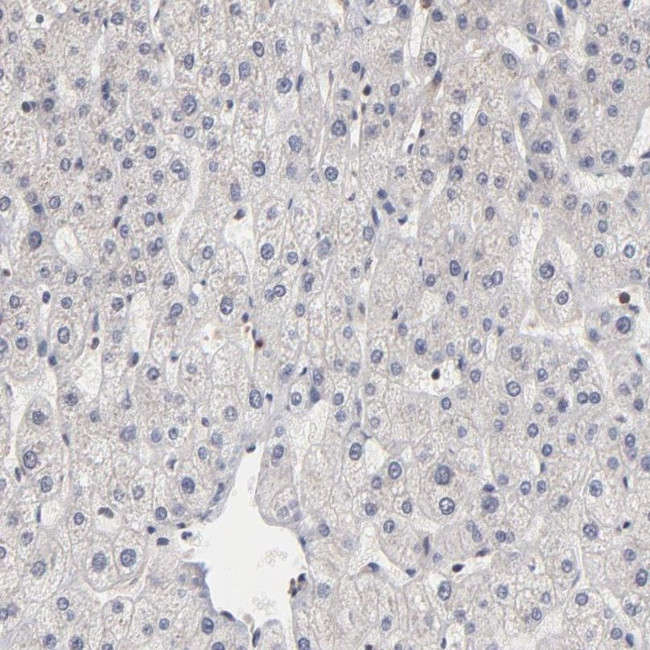 BRPF1 Antibody in Immunohistochemistry (IHC)