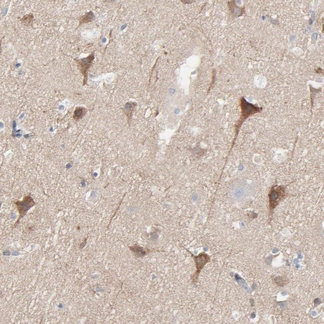 Optineurin Antibody in Immunohistochemistry (IHC)